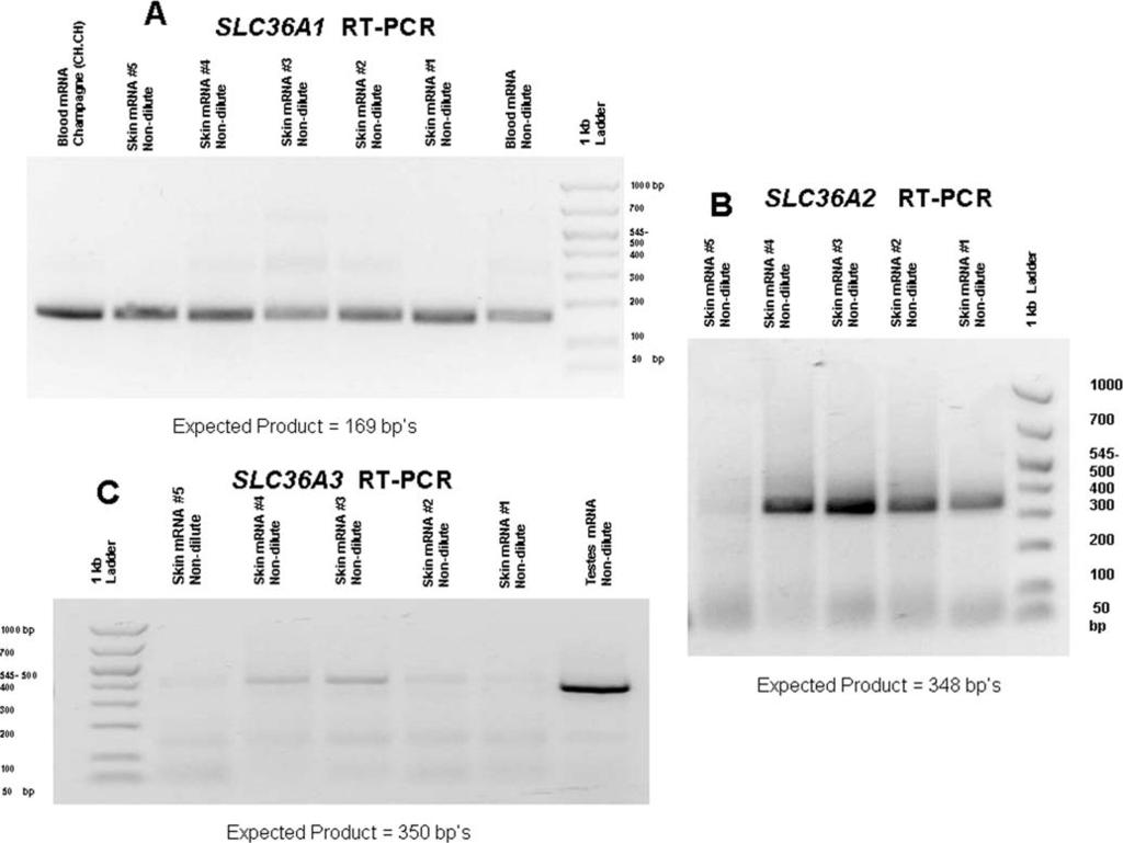 Figure 4. RT-PCR product results for SLC36A1, A2 and A3. A) RT-PCR results for SLC36A1. B) RT-PCR results for SLC36A2. C) RT-PCR results for SLC36A3.