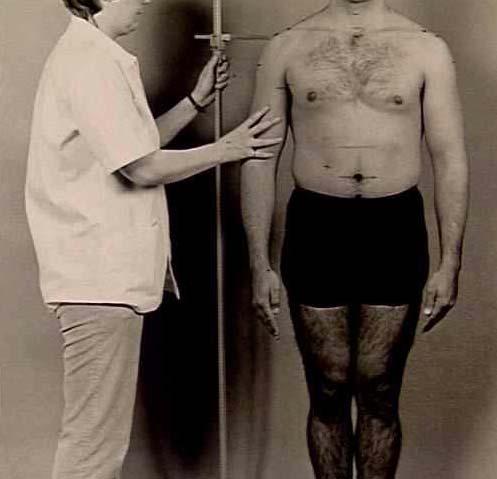 ACROMIAL HEIGHT Standing surface -- acromion, right. PROCEDURE: Subject is in the anthropometric standing position.