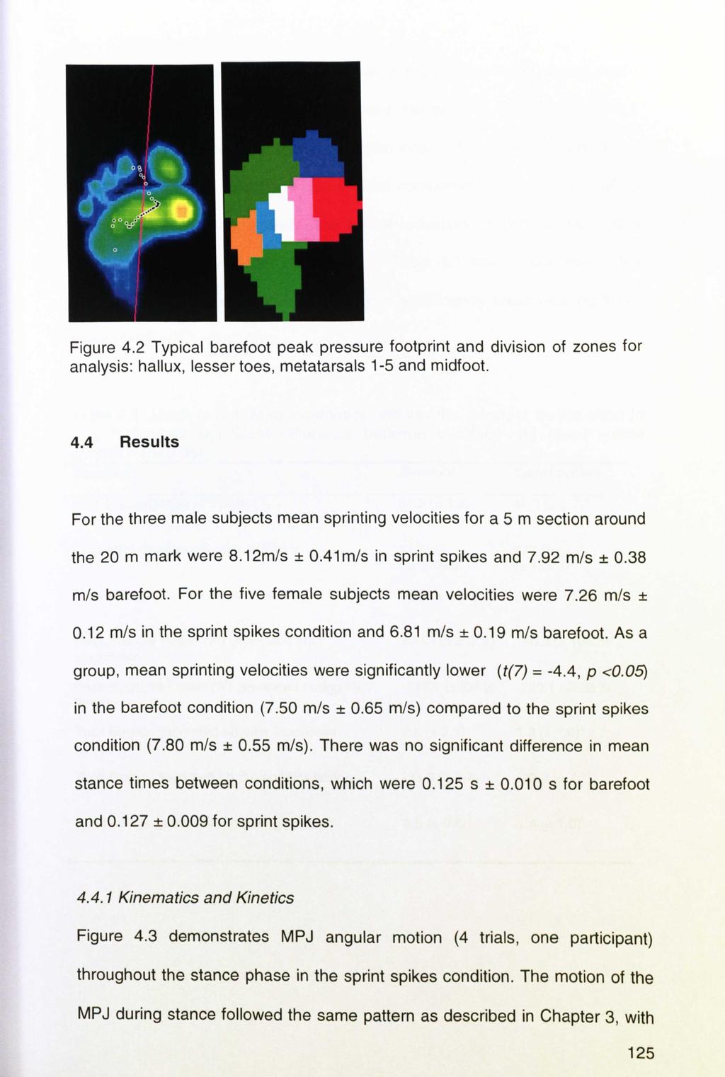Figure 4.2 Typical barefoot peak pressure footprint and division of zones for analysis: hallux, lesser toes, metatarsals 1-5 and midfoot. 4.4 Results For the three male subjects mean sprinting velocities for a 5 m section around the 20 m mark were 8.