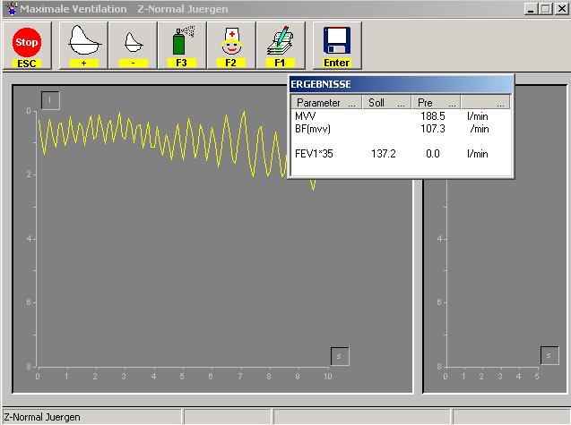 Chapter 4.4 MVV Measurement 4.4.2 Performing a MVV Measurement Select this icon or press the [Enter] key to start the measurement. On the screen the recording is displayed as a yellow line.