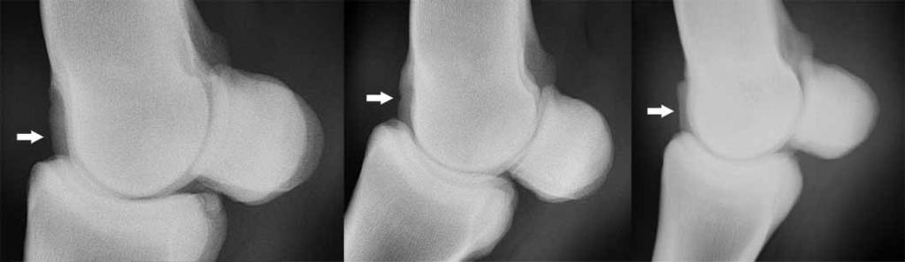 4 Lateromedial radiograph of the fetlock showig chages recorded at the distal aspect of the sagittal ridge (area II): A) irregular; B) depressio or lucecy; C) flatteed.