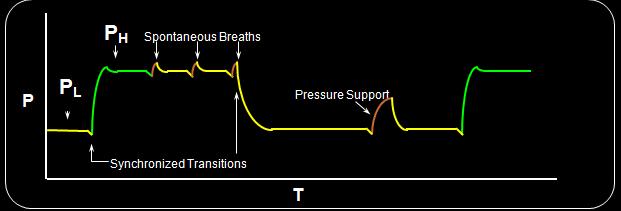 In this interval if the patient intends to breath, the transition time can be quickened or slowed according to the breathing pattern.