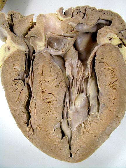 Cranial vena cava Pulmonary trunk Aortic Arch Right -