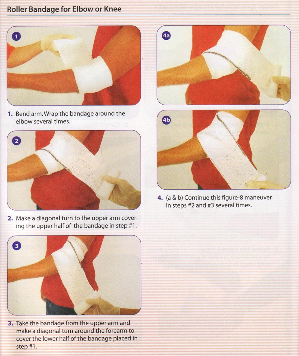 Scenario 3, continued: Knee: Using a roller bandage, Method 2 (Note** the same procedure would apply to elbows, with a