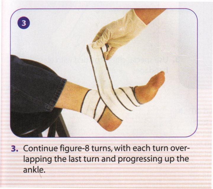 Scenario 3, continued: Follow the instructions below for wrapping ankle, then continue to do spiral bandage from