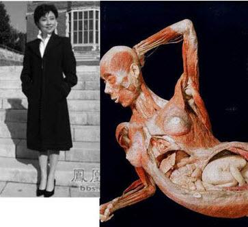 Gu Kailai got $1 Million per Slaughter Dr Gunter von Hagens, the inventor of plastination - a process whereby human cadavers are filled with plastics and sold for big profits - was Sui Hongjin's