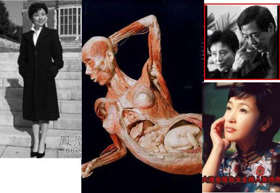 Disappeared: One Xilai an was of Zhang abortion, slept other passing Weijie with, chilling MS this former and Zhang message rumour her Dalian Weijie refused, unborn is, anonymously; TV a was Dalian