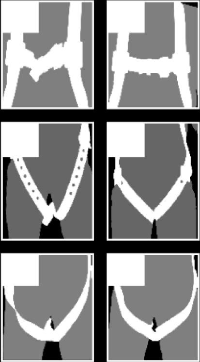 Repeat with second leg strap. Connect waist strap, if present. Waist strap should be snug, but not binding.