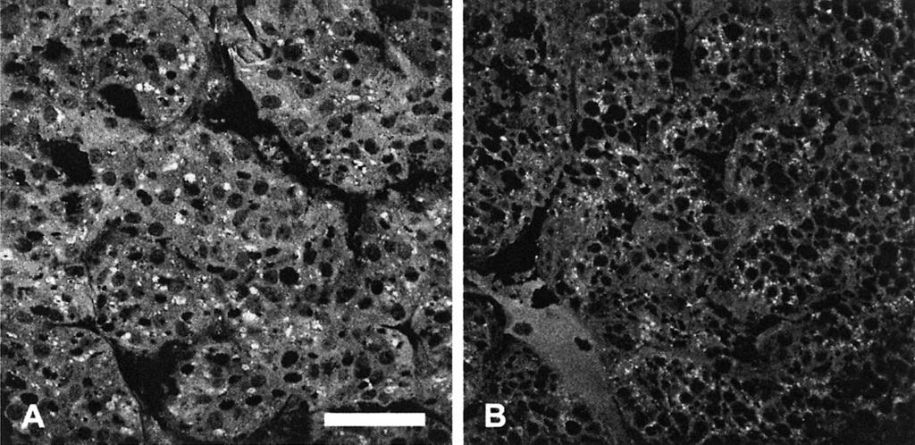 130 SIEFKES ET AL. FIG. 8. Pheromone immunostaining in the liver of spermiating (A) and prespermiating (B) male sea lampreys; scale bar in A is 50 m.