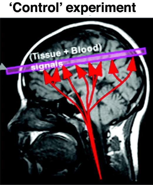 ASL Arterial Spin Labeling (ASL) doesn't use contrast agents. It is based on labeling the blood with RF pulses.