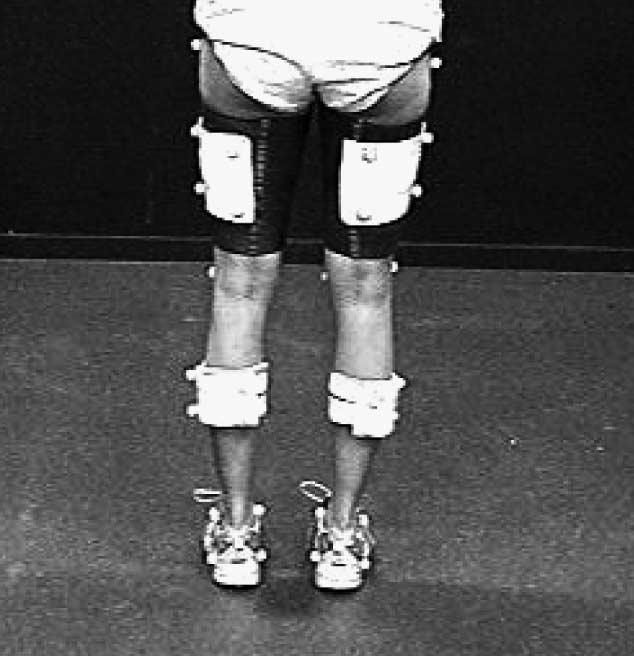 leg, and lower leg with respect to the upper leg. Joint rotation was calculated around the mediolateral, sagittal, and frontal axis.
