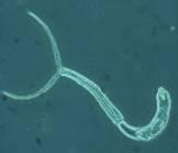 Parasite ( (Trichobilharzia Great Pond