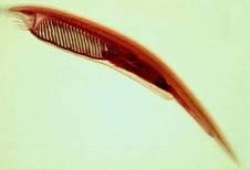 A notochord: a flexible, longitudinal rod located between the digestive tract and the nerve cord.