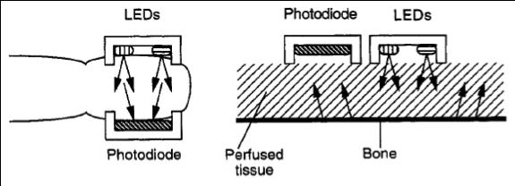 Photodetector The photodetector is the main input device of the pulse oximeter system.