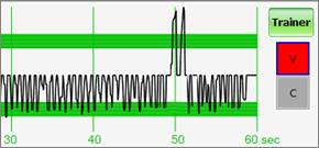 Waveform peak is inside the green zone. Compressions are too deep. Waveforms peaks mostly exceed the green zone.