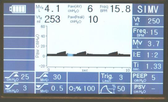 4) Monitors All modern ventilators have at least a pressure monitor measuring airway pressure.