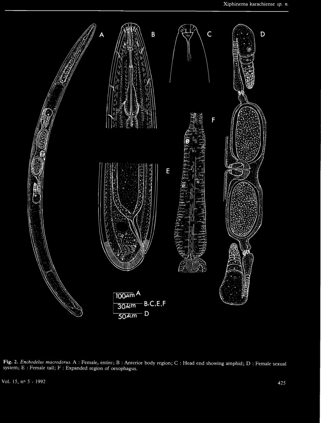 A : Female, entire; B : Anterior body region; C system; E : Female
