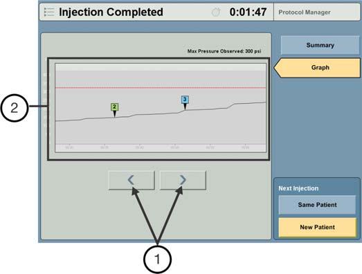Stellant with Certegra Workstation 11.2 Injection Aborted Figure 11-2: Injection Complete - Graph 1. Select the left or right arrow to scroll through the injection history. 2.