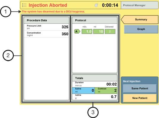 If the injection was halted, the Injection Aborted screen displays. 1. The System displays a reason why the injection aborted at the top of the screen. 2.