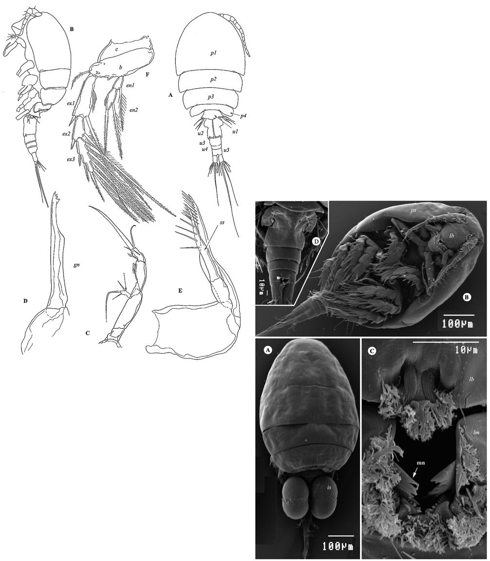 1: Female of A. mammillatus; A: Habitus, dorsal; B: Habitus, lateral; C: Antenna; D: Mandible; E: Maxilla; F: Leg 4.