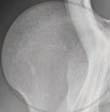 One of the most difficult to manage injuries is a posterior shoulder dislocation of the hitting arm a potentially polo sport ending injury.