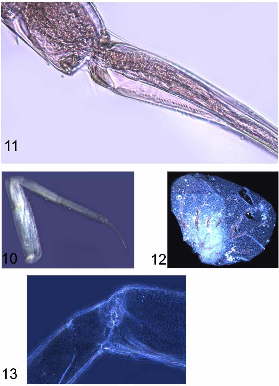 FIGURES 10 13. Waynokiops dentatogriphus, new genus, new species. 10. Mesothoracic leg. 11.