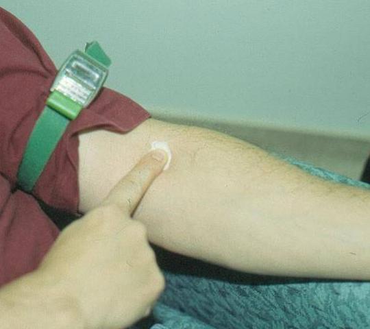 Figure 5-XXIII: Apply Pressure until Bleeding has Stopped Do not leave needle caps and other material in patient s room discard properly.