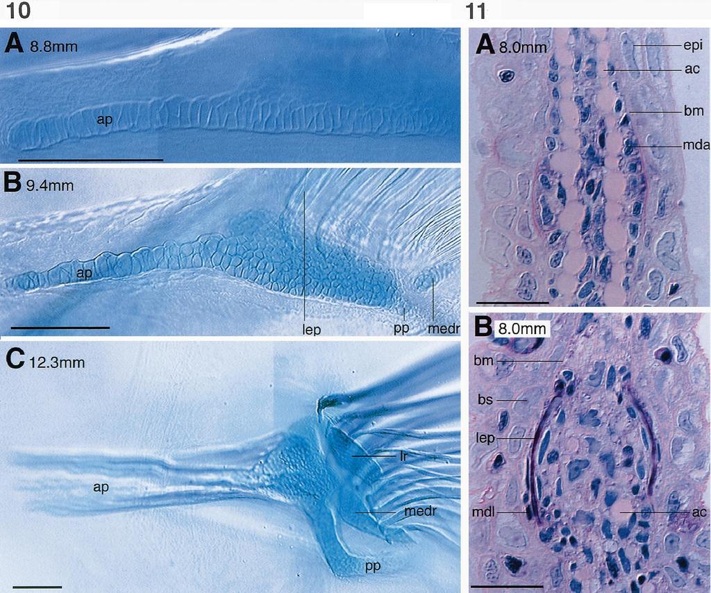 112 H. Grandel, S. Schulte-Merker / Mechanisms of Development 79 (1998) 99 120 Fig. 10. (A C) Alcian-blue stainings of developing larval pelvic endoskeletons. (A) 8.8 mm larva (B) 9.4 mm larva (C) 12.