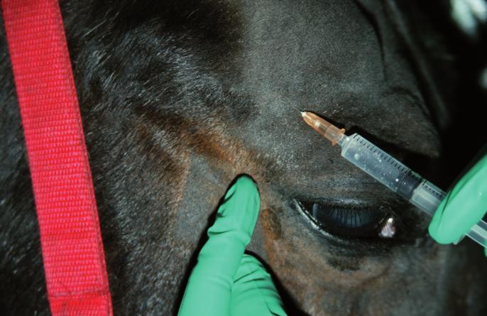 An auriculo-palpebral (motor) nerve block paralyses the upper eyelid