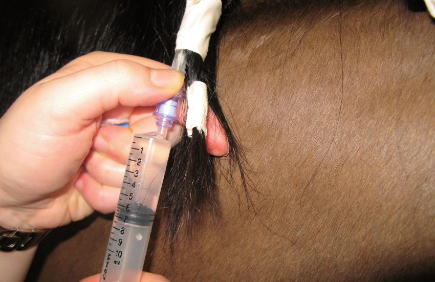 Figure 15: Flushing the catheter with 5 10 ml saline tests the patency of the
