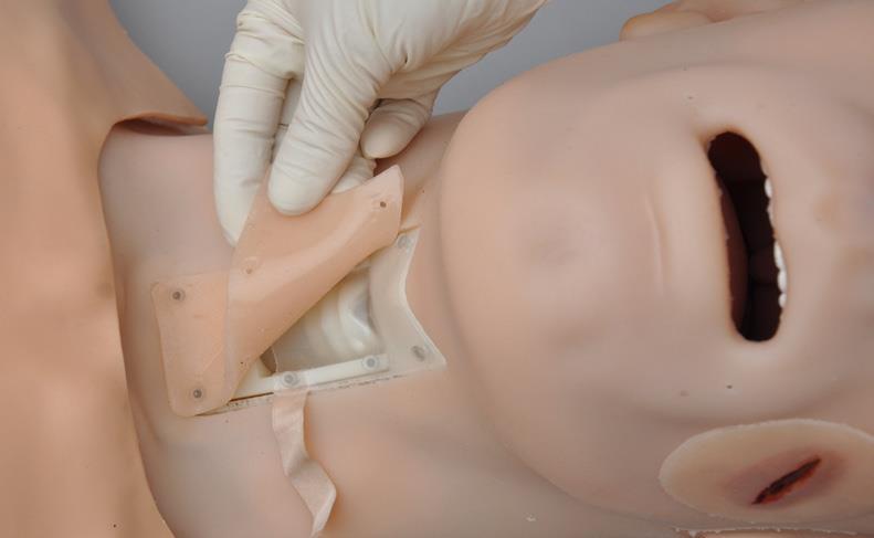 Remove the trachea skin cover from the simulator The surgical assembly is ready to perform tracheostomy procedures.