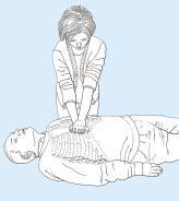 EUROPEAN RESUSCITATION COUNCIL (m) Recovery position: Place the arm