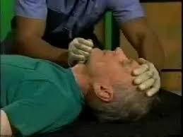 Open the Airway Turn the victim onto their back Look in the mouth for foreign body and remove what you safely can (don t do blind finger sweeps as this can convert a partial airway obstruction to