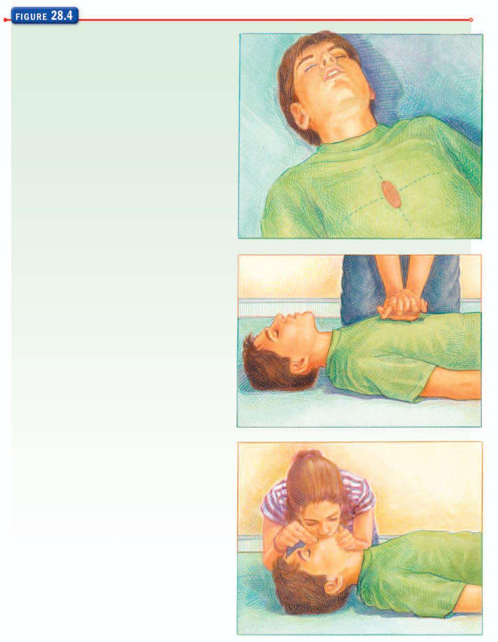 ADULT CPR CYCLES Position your hands. To begin chest compressions, find a spot on the lower 1half of the victim s breastbone, right between the nipples.