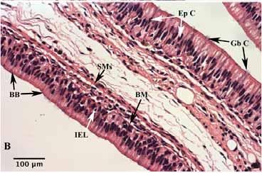Submucosa is thicker and shared by both epithelial layers of mucosal tissue. Submucosa is mainly comprised of adipose tissue.