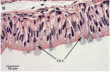 Abbreviations: Ad Ts: adipose tissue, BB: brush border, BM: basement membrane, BV: blood vessel, Ep: epithelium, Ep C: epithelial cell, Gb C: goblet cell, IEL: intraepithelial lymphocyte, LP: lamina