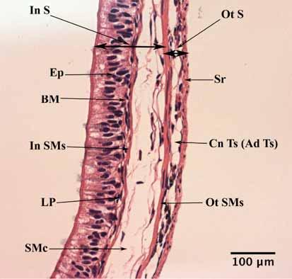 Anatomy and Histology of the Spiral Valve Intestine The Open Zoology Journal, 2009, Volume 2 81 However goblet cells are frequent in the superficial layer of these structures as well.