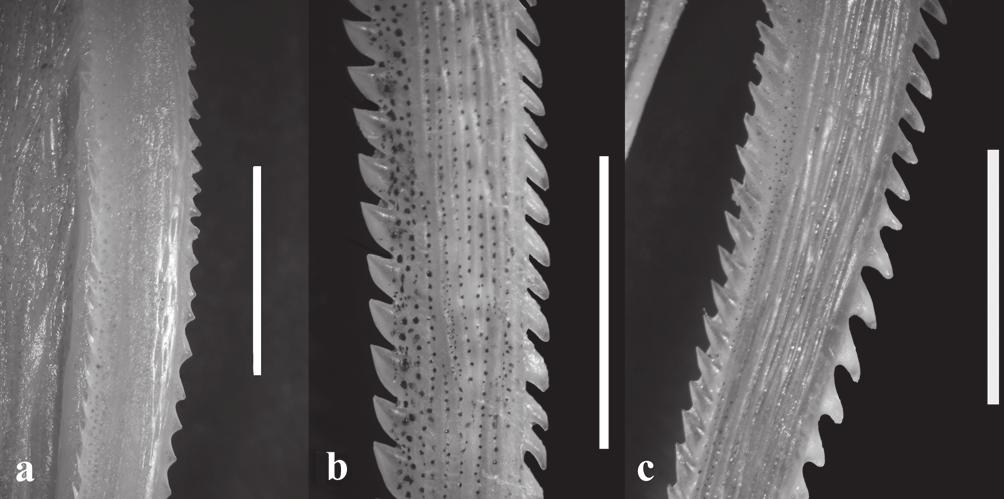 M. M. Azpelicueta & H. A. Britski 47 Fig. 2. Detail of the pectoral spine. a, Iheringichthys syi, AI 279, 166.1 mm SL; b, Iheringichthys megalops, AI 296, 154.
