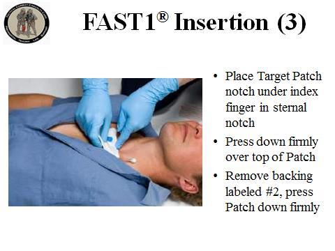 INSTRUCTOR GUIDE FOR TACTICAL FIELD CARE #2 IN TCCC-MP 1708 19 FAST1 Insertion (3) 49.