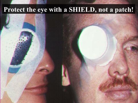 INSTRUCTOR GUIDE FOR TACTICAL FIELD CARE #2 IN TCCC-MP 1708 45 117. Protect the eye with a SHIELD, not a patch!