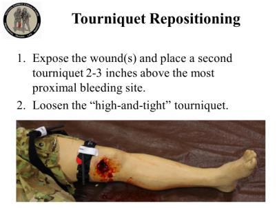 blood entering the extremity but not being able to get out. Although a tourniquet may stop the active bleeding, it also prevents venous blood from returning to the heart.