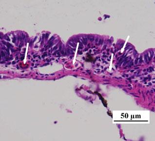 (j) Show the anterior intestine of 45 DAH larvae (HE).