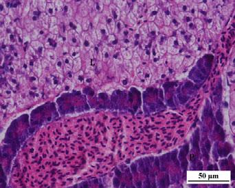 Numerous lipid vacuoles was visible in the liver at 11 DAH (Fig. 5b).
