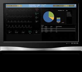 Perfusion Data Management From VIPER to VISION and LIVE VUE VISION is a sophisticated server