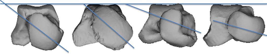 NATURE COMMUNICATIONS DOI: 1.138/ncomms9432 ARTICLE a LPP RE PT LPP RE PT Homo sapiens Pan troglodytes b PT LPP RE Homo naledi (U.W. 11 1322) LPP RE PT Australopithecus sediba c Pan troglodytes Au.