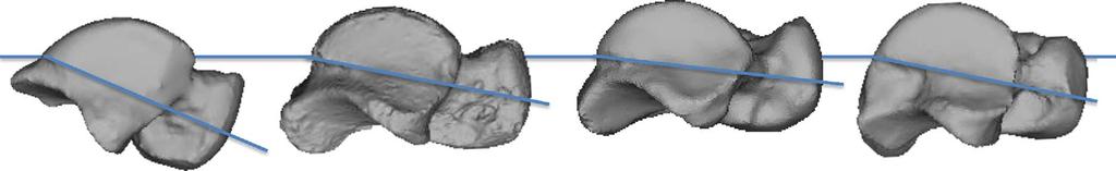 naledi foot. (a) The calcaneal anatomy of H. naledi resembles that of modern humans.