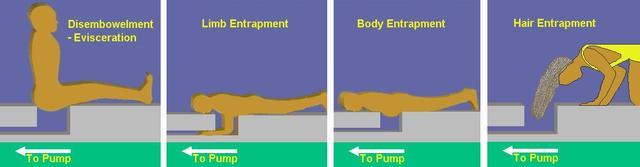 Entrapment - Types Hair: hair caught in faulty drain cover Limbs: arms, legs, fingers lodged in suction opening Body: any body part that covers a drain