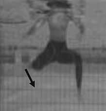 According to Sanders (2005), the propulsion and the height that the water polo player can maintain through the execution of the eggbeater kick is determined by the ability to generate high foot