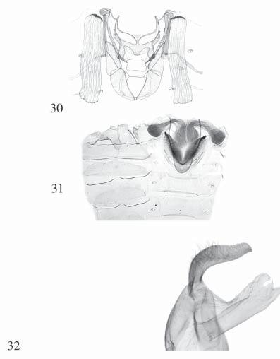 Figs. 30 33. Figs. 30 31, basal abdominal brushes and central pocket of Noctuidae. 30. Hadeninae: Mythimna (Hypopteridia) reversa (MOORE)) (from ZILLI, 1997: 506, fig.