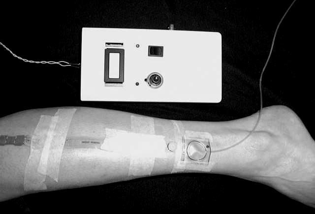 pressures achieved with different bandages during calf muscle contraction and relaxation